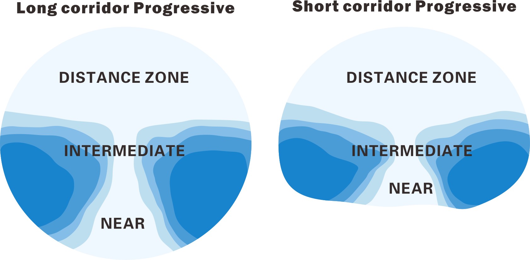 Progressive Lenses,External Progressive Design (4)